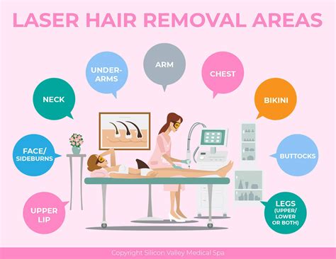 laser hair removal areas